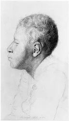 Cretin, profile, illustration from an unpublished treatise by Jean Etienne Dominique Esquirol on the lunatics of the Salpetriere asylum